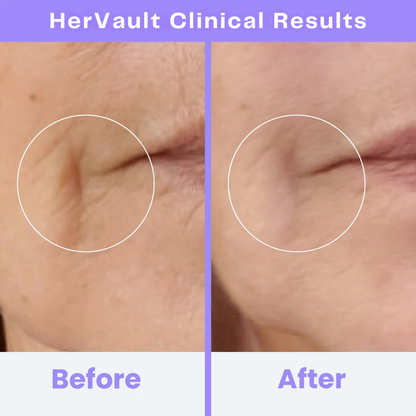 HerVault CLINICAL HIGH FREQUENCY WAND
